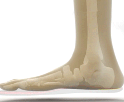 Orthopedic Arch Insoles